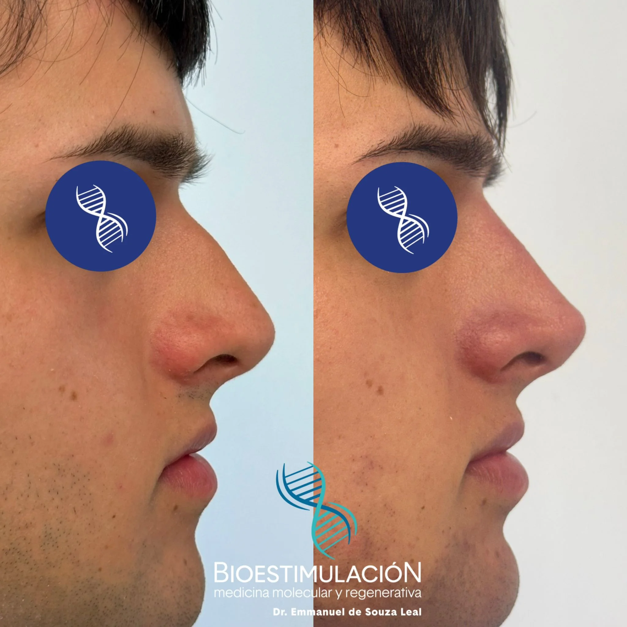 Resultado de armonización en Montevideo – Bioestimulación